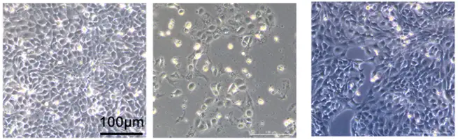 Prevent UV Damage with Skin Microbiota Product